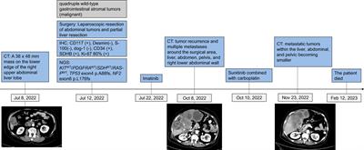 Case Report: A novel TP53 mutation in a patient with quadruple wild-type gastrointestinal stromal tumor